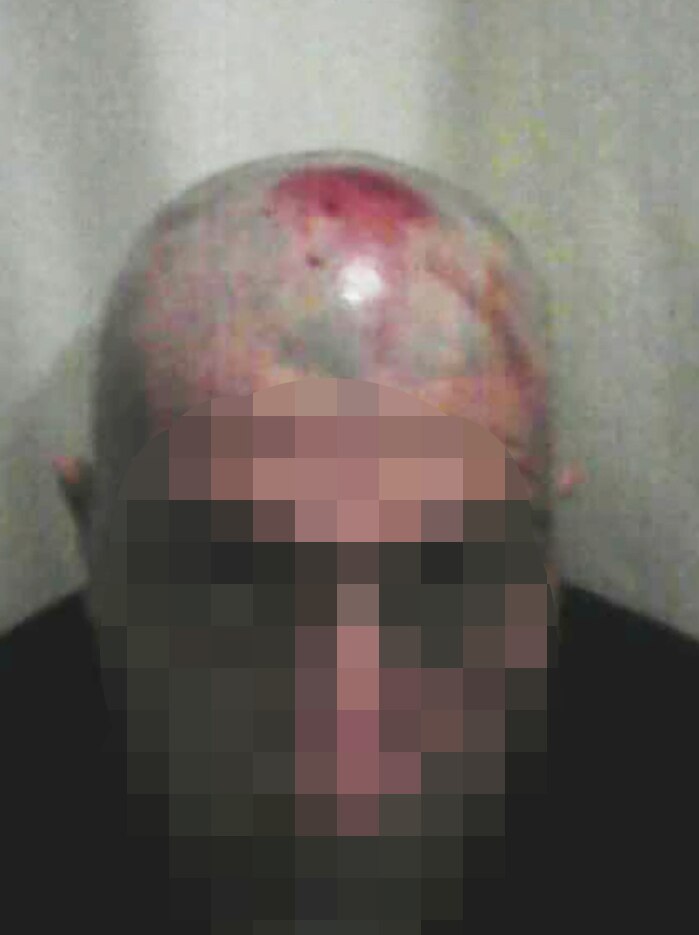 Photo showing a man's head wound.