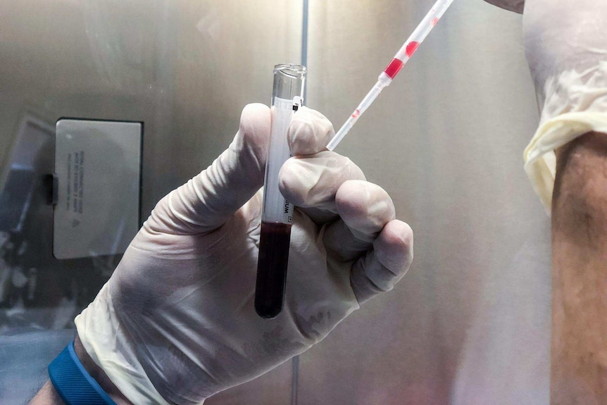 Vial of blood being tested for HTLV-1 virus