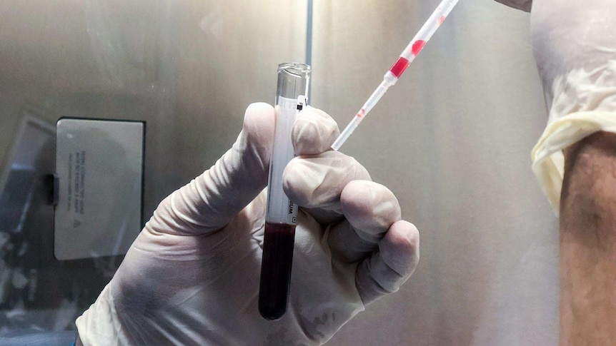 Vial of blood being tested for HTLV-1 virus