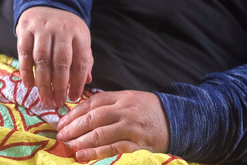 Injured worker Caroline Harte lies her sore and swollen hands on her lap