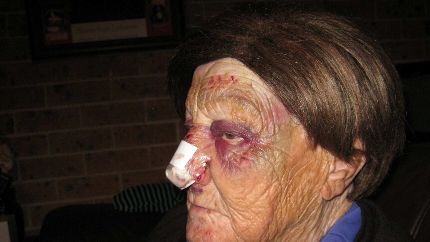Lorrette Doueihi was assaulted in the street in Moorebank in an attempted robbery.