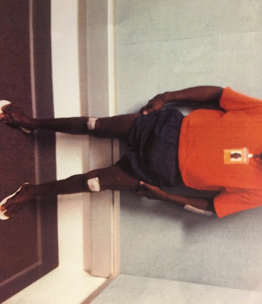 Patrick Cumaiyi wears and orange shirt and has bandages on his knees