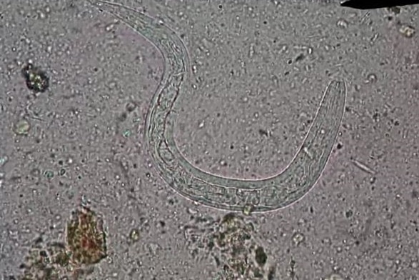 A microscope image of a parasitic worm.