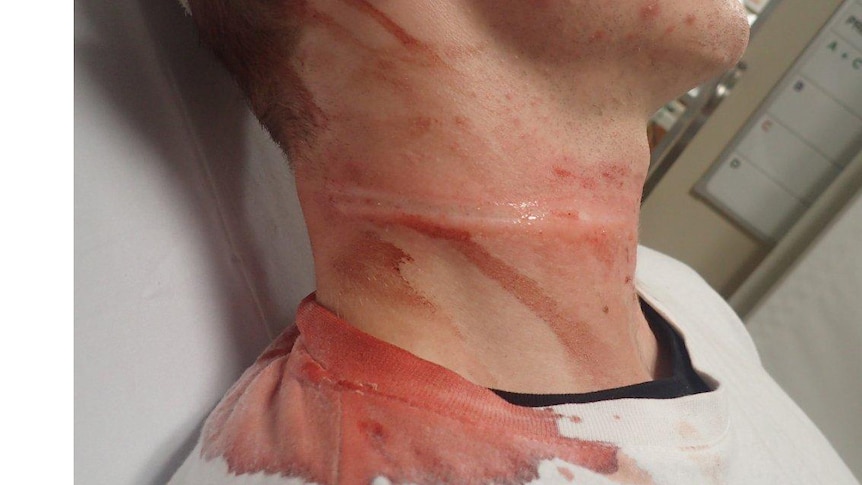 The neck injuries received by a motorist when he rode into a rope that was strung across Perth's Wellington Street.