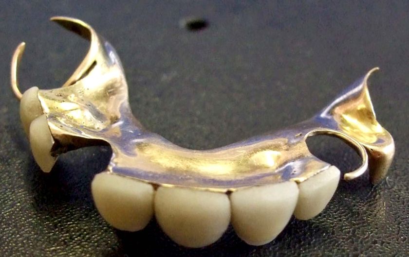 Churchill's dentures snapped up at auction - ABC News