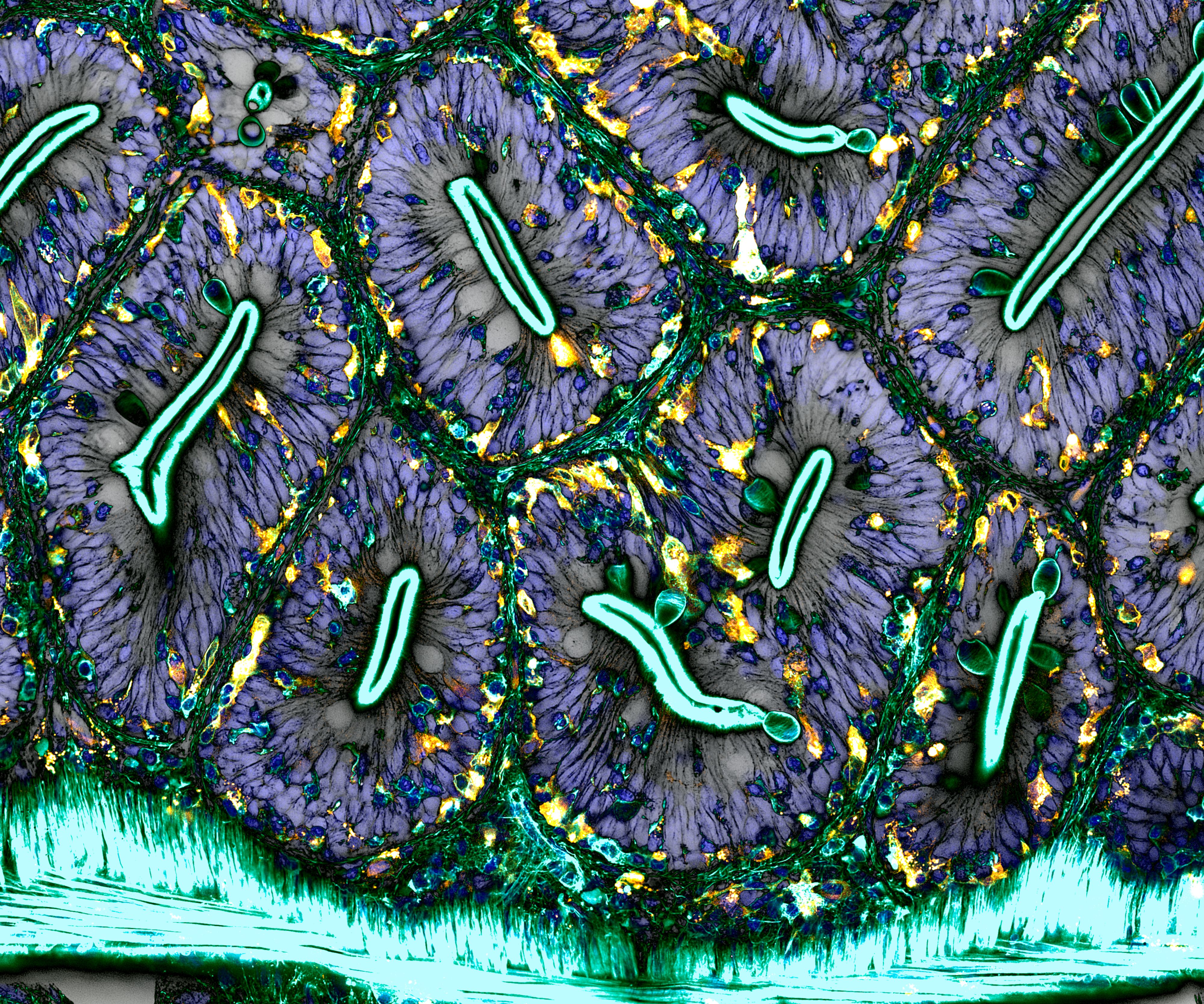 an extremely close up image of a network of macrophages inside a fish intestine lit up in purple blue and green colours