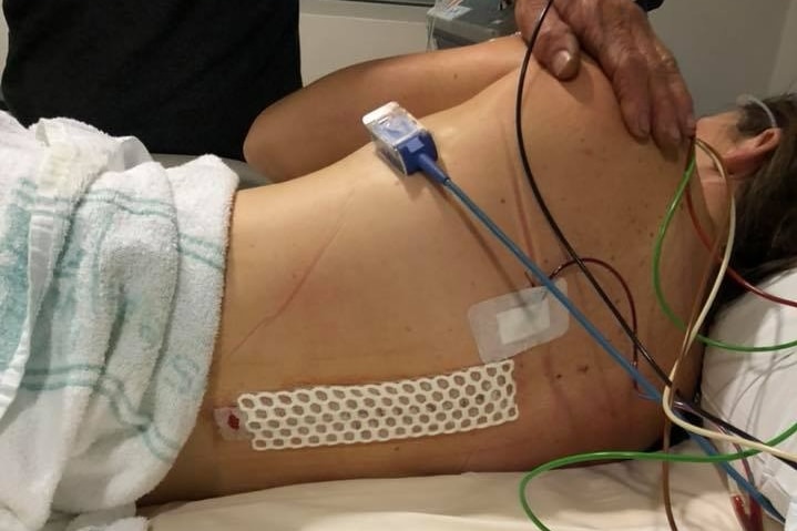 A woman lies facing away from the camera with a gauze running vertically down her spine