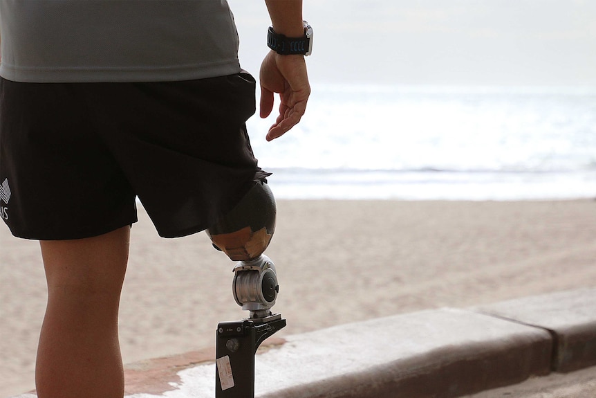 A man in a grey t-shirt and black shorts with a prosthetic leg stands in front of a beach.