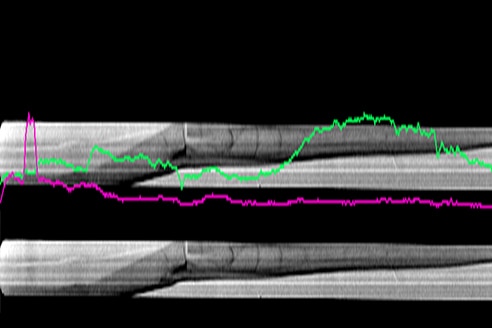 Feather X-Rays