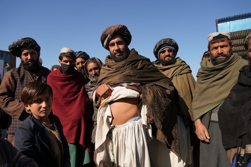 One in a group of Afghan men lifts up his shirt and points to a scar on his belly. 