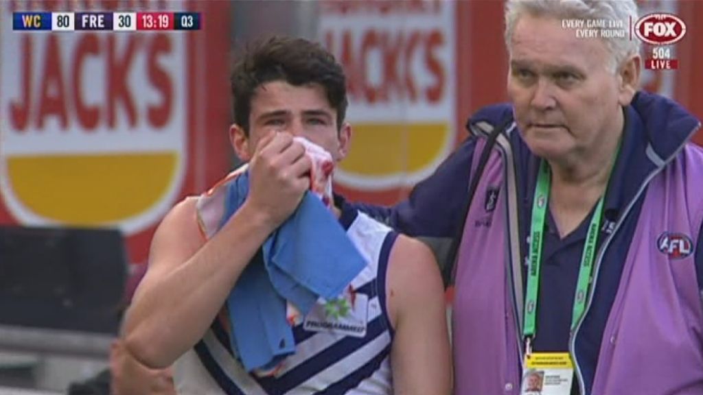 Parolee Sentenced Over Jaw Breaking Punch But Will The Decision Echo Outside Country Footy Abc News