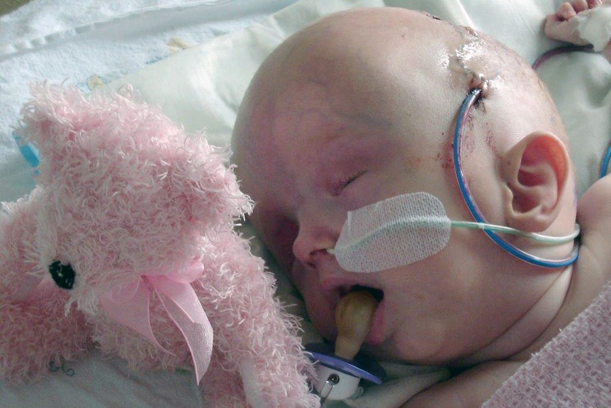 Jess Jackson as a baby in hospital with tubes in her nose and the side of her head.