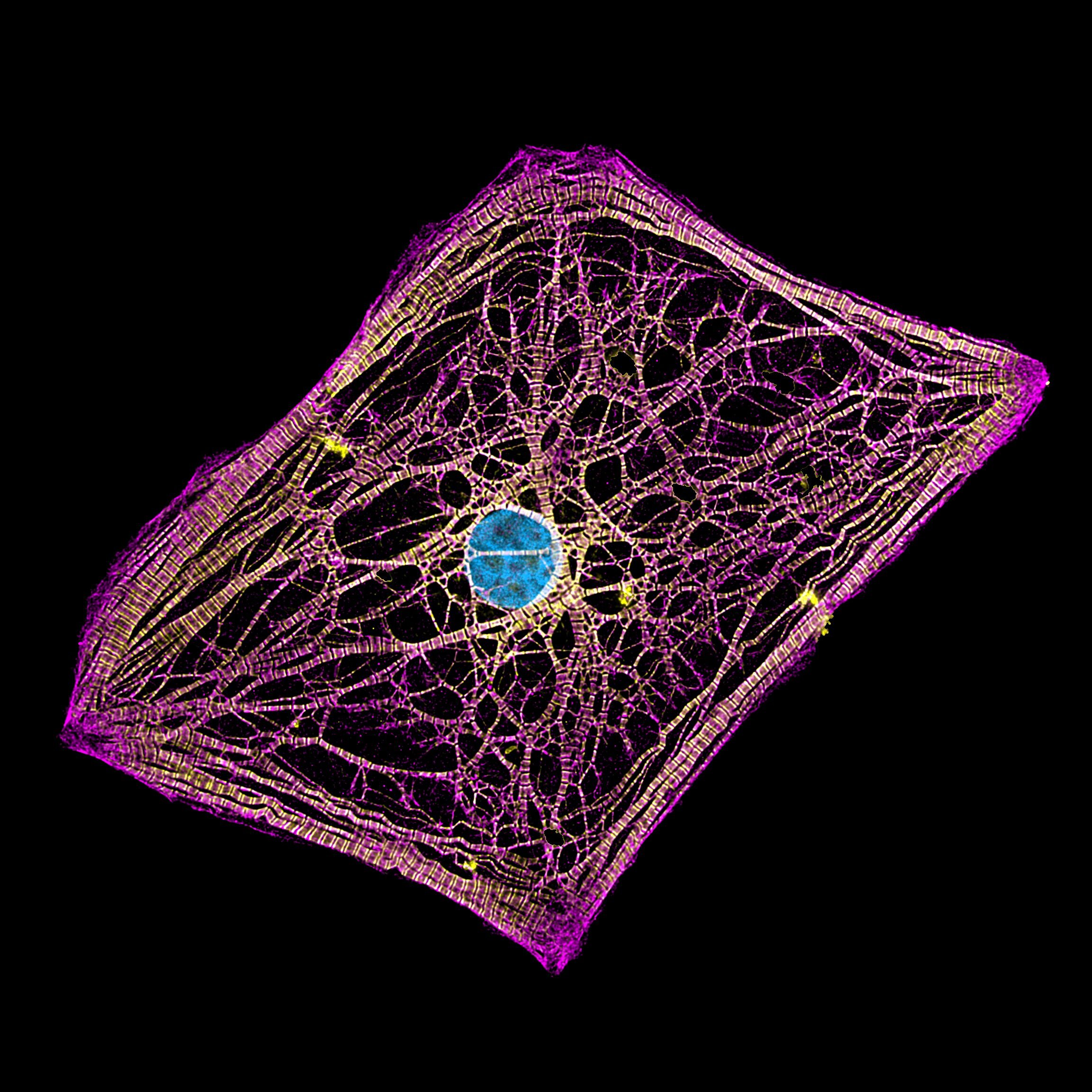 a diamond-shaped network of human heart cells shown in purple and yellow with a blue centre dot