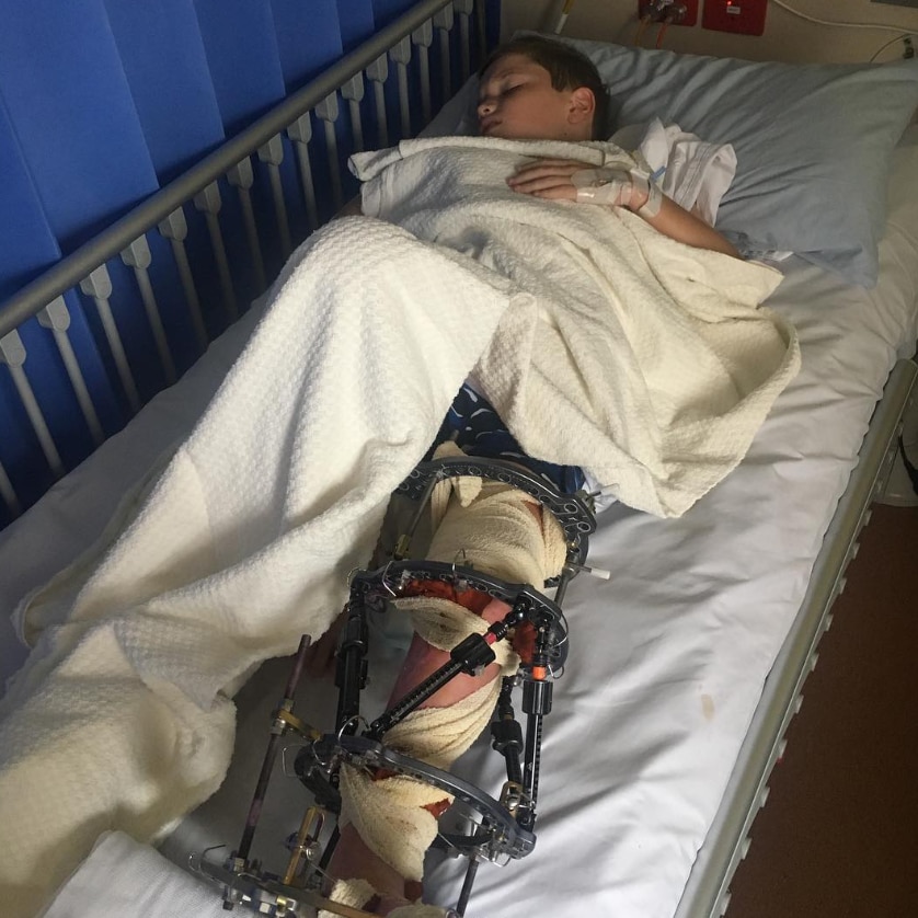 A boy lies in a hospital bed with a brace around his leg.