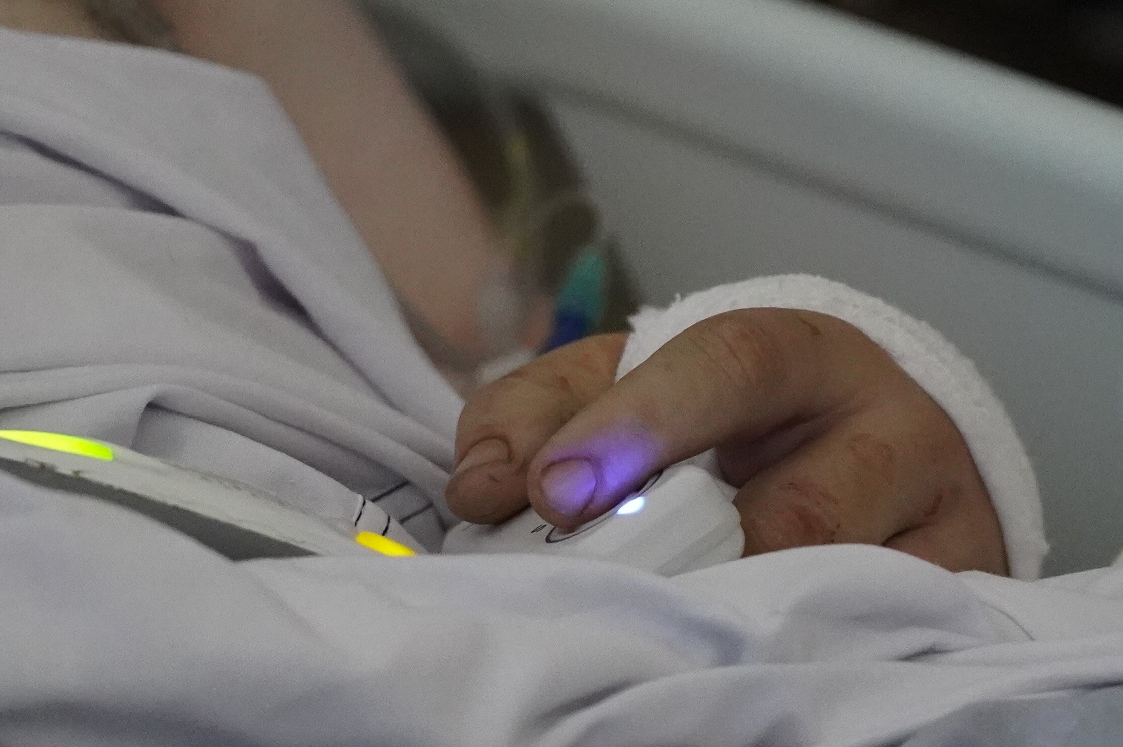 Patients being treated at the Royal Melbourne Hospital road trauma unit.
