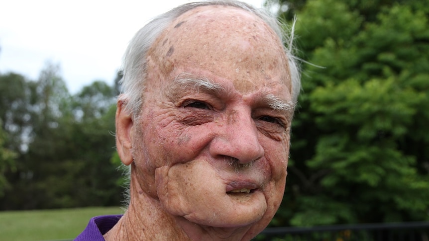 A man's face with a disfigured jaw