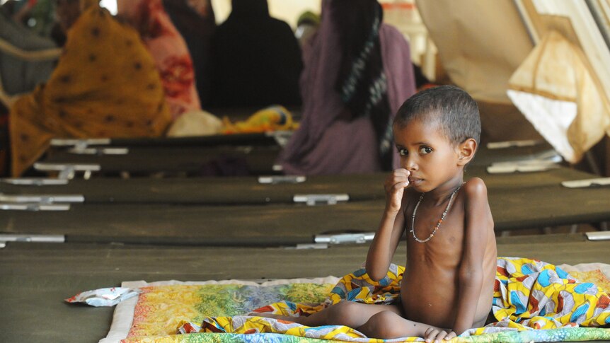 Malnourished child in West Africa