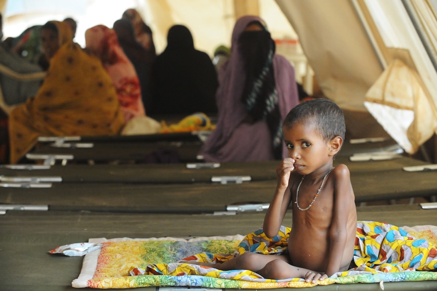 Malnourished child refugee