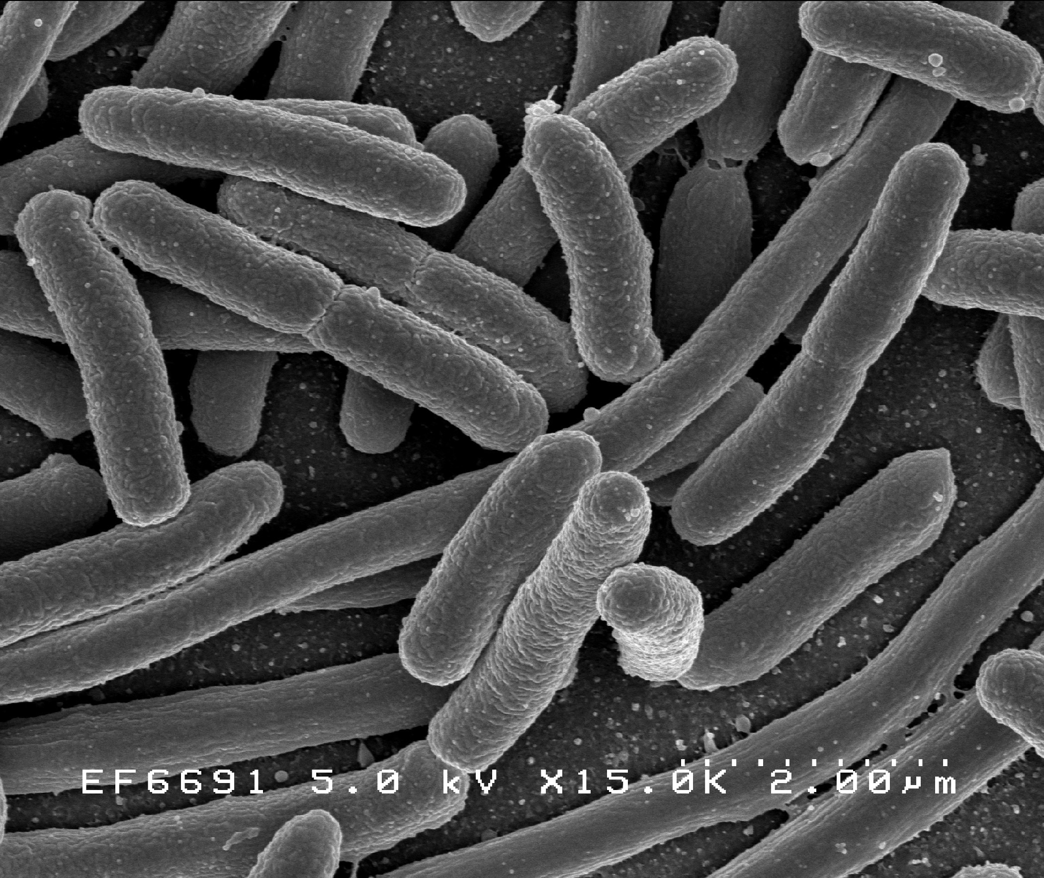 Grayscale image of rod-shaped bacteria.