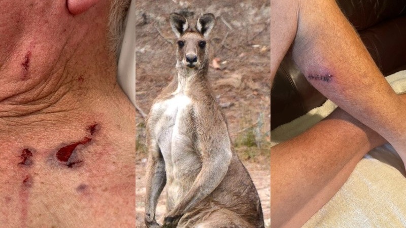 a grey kangaroo stands in a collage of photos of scratches received by an elderly man