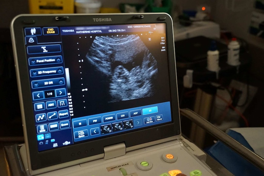 A sonography scan in a remote NT health clinic.