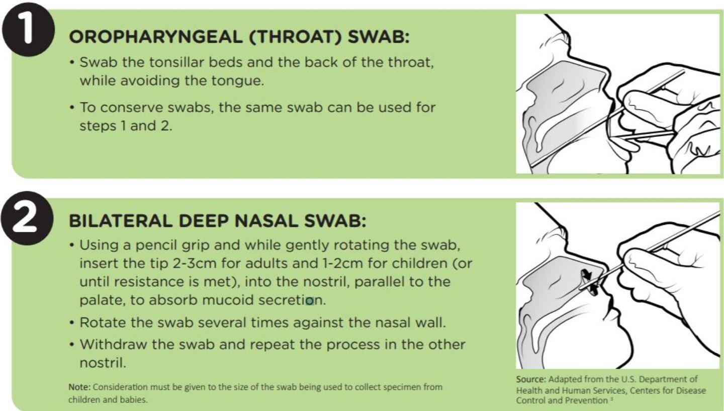 A series of two diagrams, one from a sample being taken from someone's mouth, the other from a nasal passage.