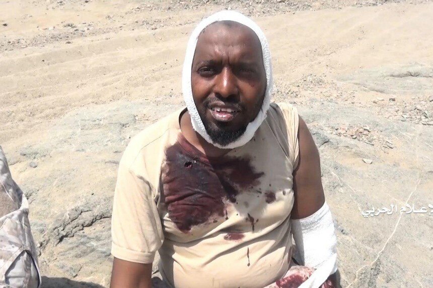 A man wearing a blood-stained shirt and a bandage on his head sits on a rock.