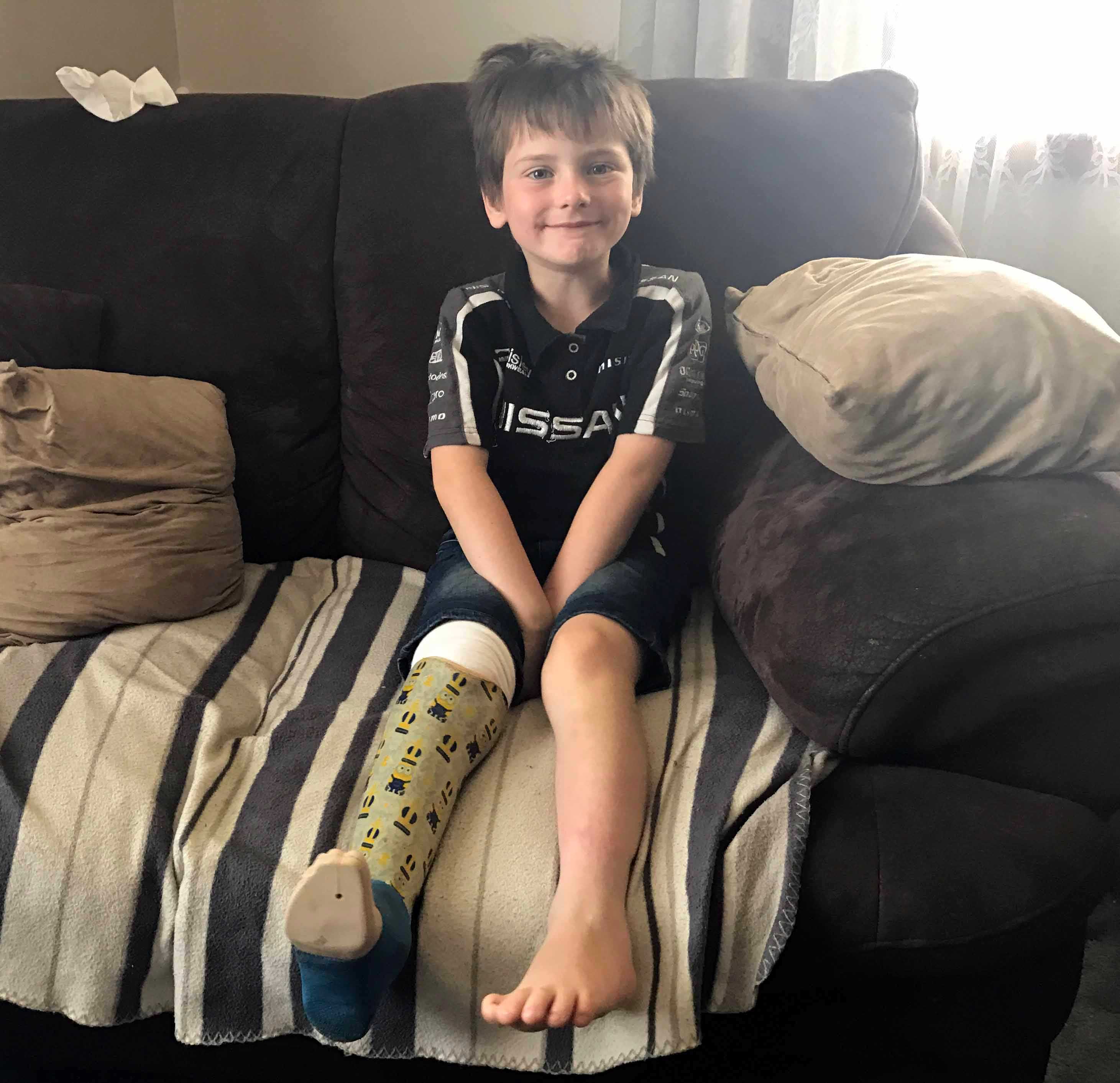 prosthetic-foot-delay-threatens-to-delay-tasmanian-boy-s-start-to