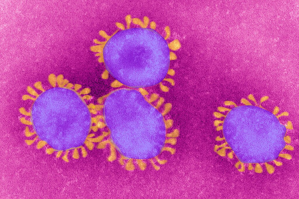 What does the coronavirus reveal about us?