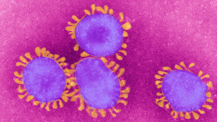 Depiction of the crown-like coronavirus cells visible under a microscope.