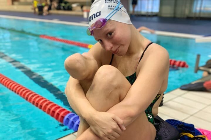 A young swimmer wearing a cap and bathers sits poolside, as she hugs both legs. The right leg is amputated below the knee.
