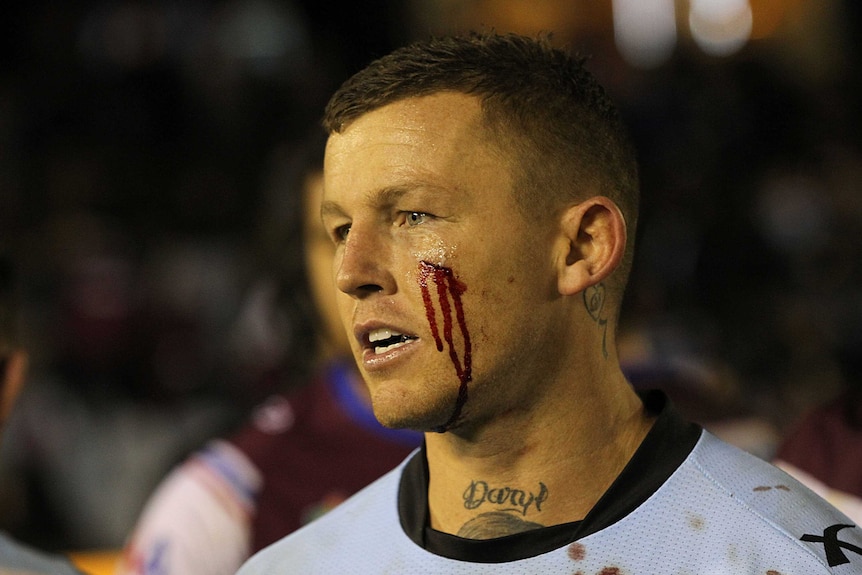 Controversial rugby league player Todd Carney with a bloody cheek during an NRL match in 2014.