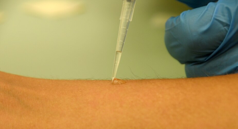 Hookworms don't just wiggle in your feet and cause extreme pain, they