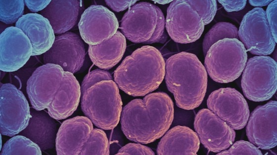 Purple and blue scan of Neisseria gonorrhoea bacteria.