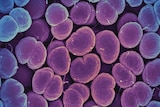 Purple and blue scan of cell-like organisms viewed under microscope.