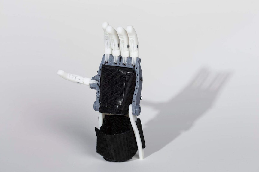 Prosthetic hand