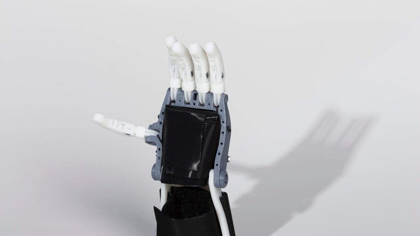 Prosthetic hand