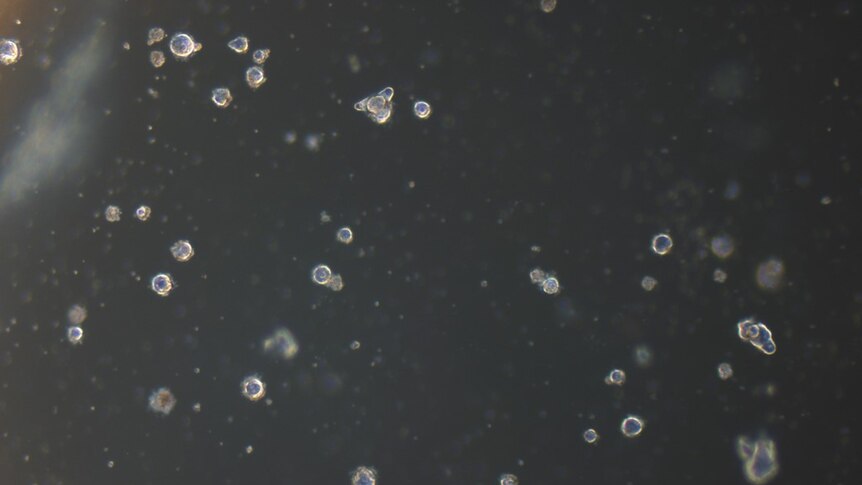 Micro lens cells grown from human lens cells in a lab