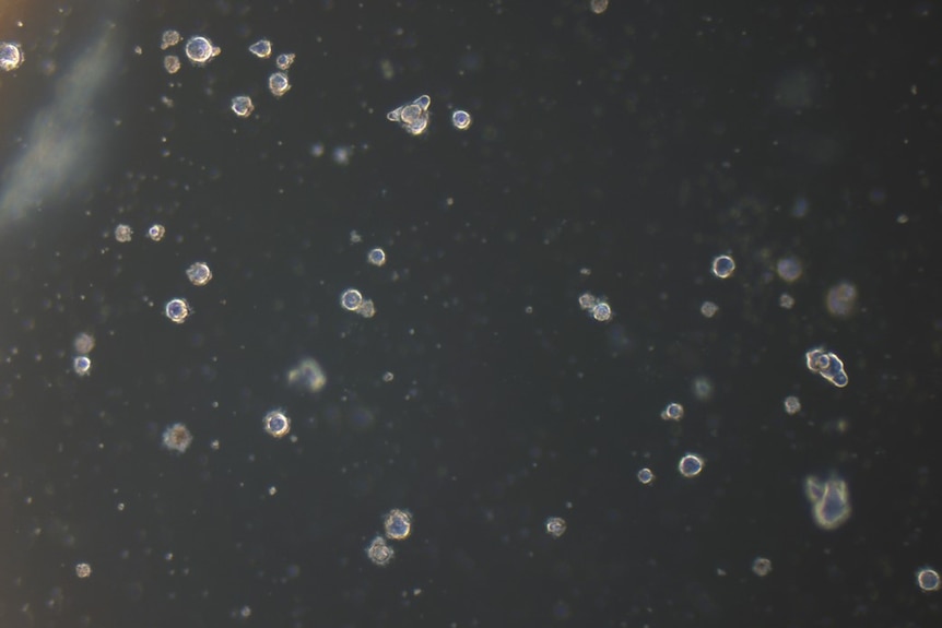 Micro lens cells grown from human lens cells in a lab