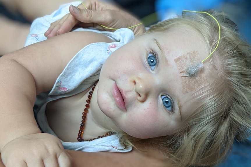 Baby looking at the camera with big blue eyes and a sensor taped to her forehead
