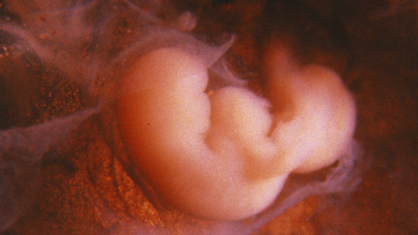 An image of the human embryo at 4 weeks showing embryonic heart, thickened spinal cord and clusters of nerve cells