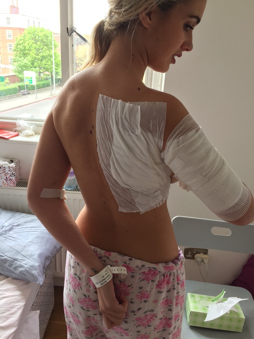 Isobella Fraser with bandages on her back and arm.