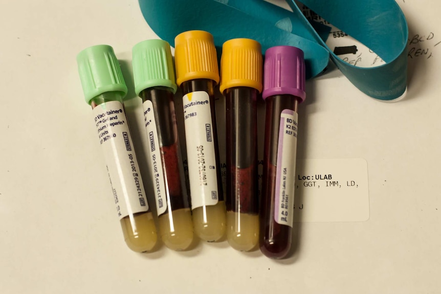 Five labelled vials of blood lie on a medical envelope.