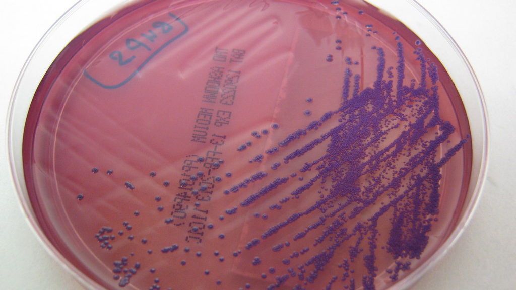 Video: Bacterial disease living in soil kills two people in Queensland, region