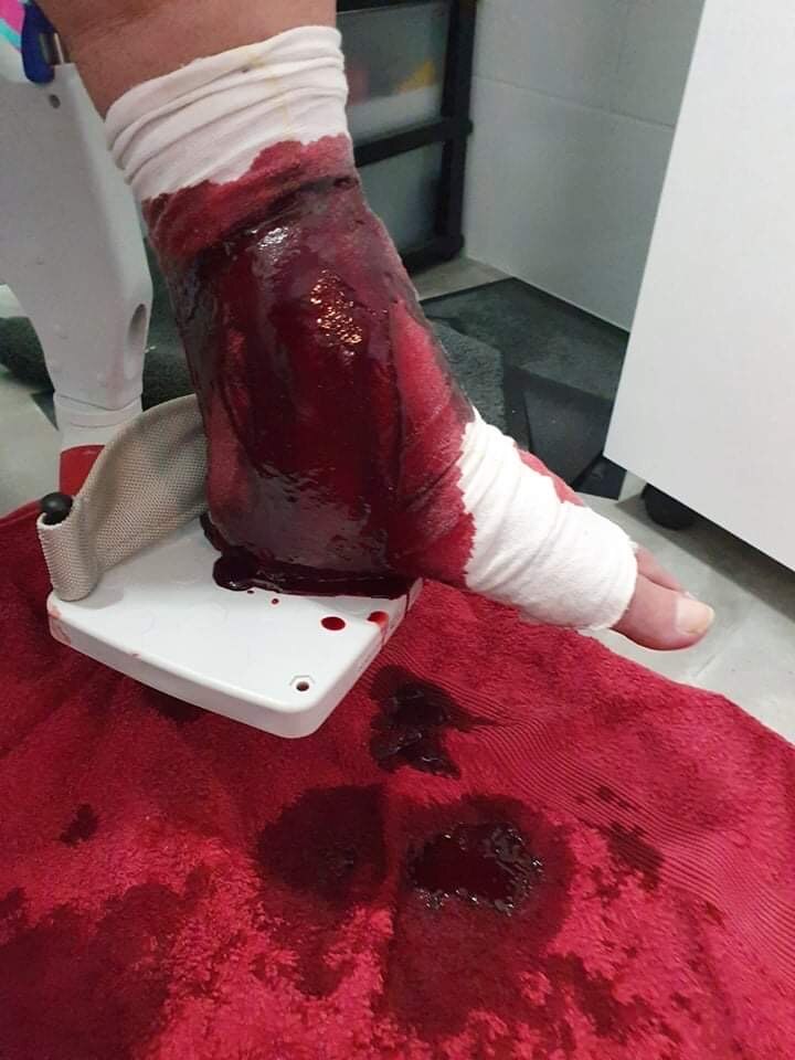 A bandaged foot with blood pouring out of a wound and onto the floor.