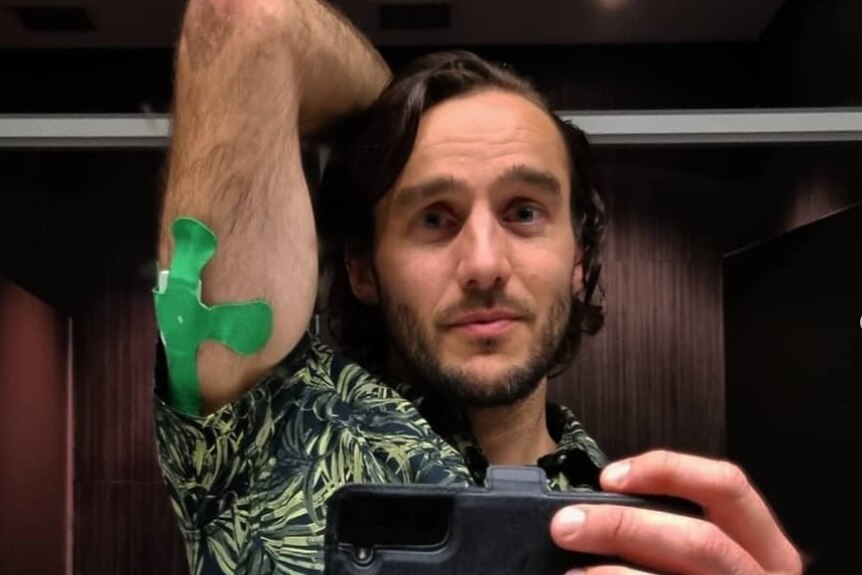 Man with brown medium length hair and wearing a green collard shirt has his arm up and behind his head to show his insulin pump