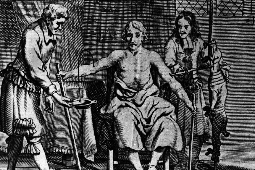 An etching of a worried-looking patient receiving a blood transfusion from a dog in the 1600s