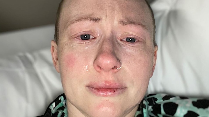 Jodie Leworthy with shaved head lying in a hospital bed with a tear rolling down her right cheek.