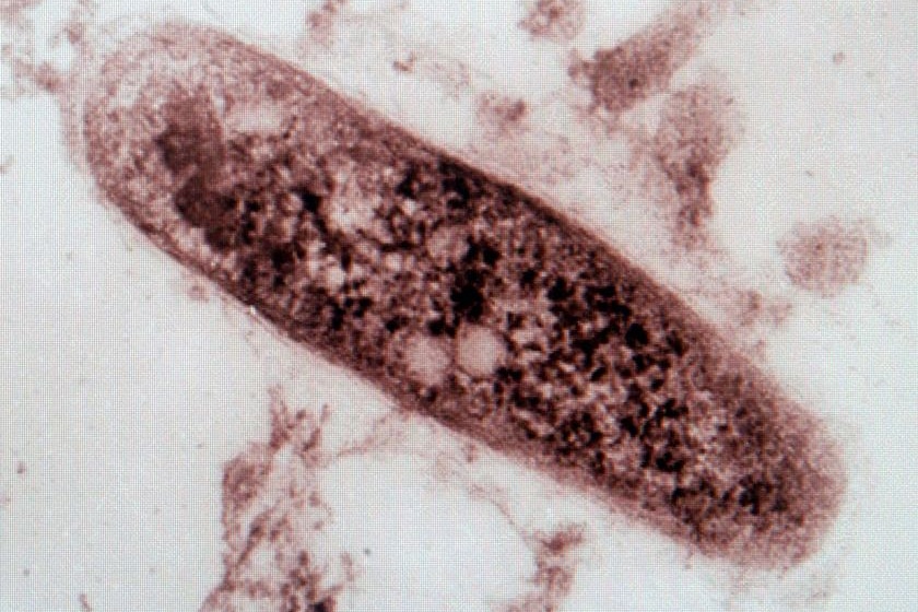 Magnification of Tuberculosis