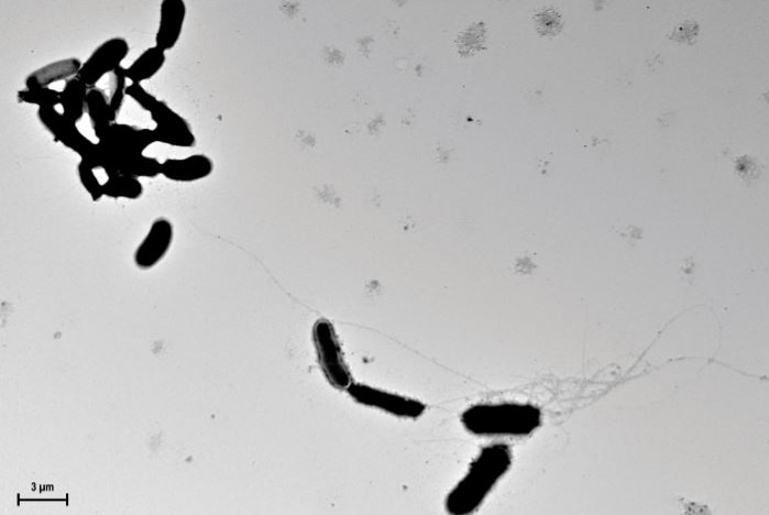 Fibrils of beta amyloid capture Candida albicans in culture medium